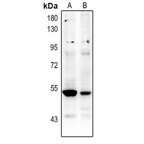 p53 (Acetyl-K381) Rabbit Polyclonal Antibody