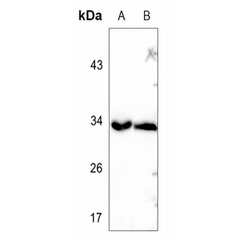 TRADD Rabbit Polyclonal Antibody