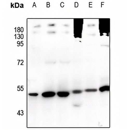 TRIM38 Rabbit Polyclonal Antibody