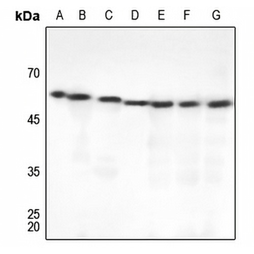 Beta-tubulin Rabbit Polyclonal Antibody