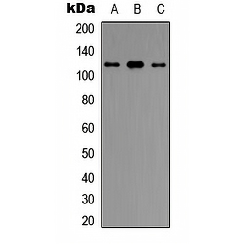 UBE3C Rabbit Polyclonal Antibody