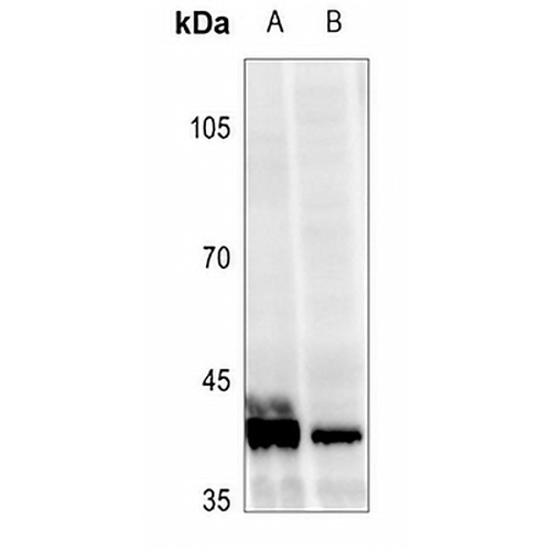 VDR (Phospho-S208) Rabbit Polyclonal Antibody