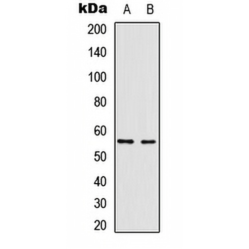 Vimentin Rabbit Polyclonal Antibody