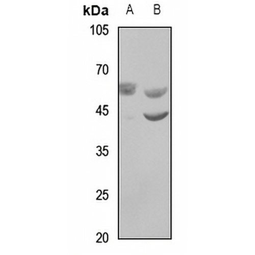 WASF3 Rabbit Polyclonal Antibody