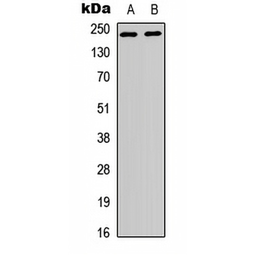 WNK1 Rabbit Polyclonal Antibody