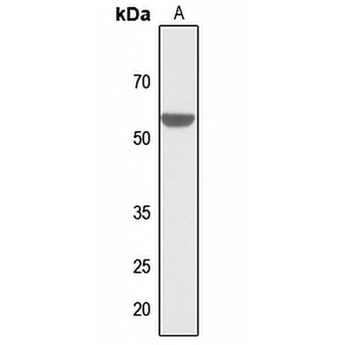 ZIC1/2/3/4/5 Rabbit Polyclonal Antibody