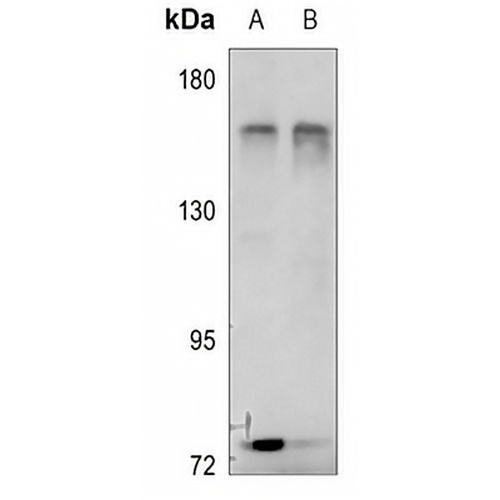 RACK7 Rabbit Polyclonal Antibody