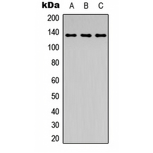 ABL1 (Phospho-Y204) Rabbit Polyclonal Antibody
