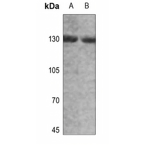 Alpha-adducin (Phospho-T445) Rabbit Polyclonal Antibody