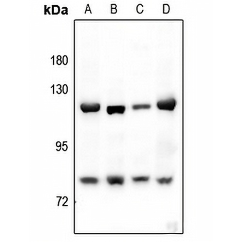 Alpha-adducin Rabbit Polyclonal Antibody