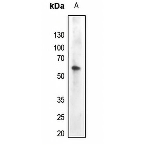 AKT (Phospho-Y474) Rabbit Polyclonal Antibody