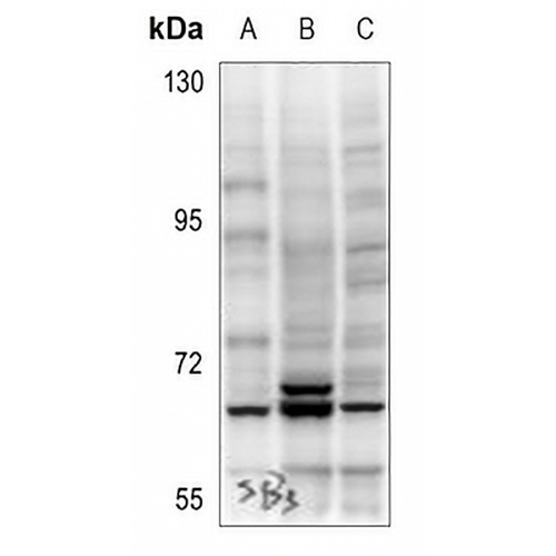 AKT (Phospho-S473) Rabbit Polyclonal Antibody