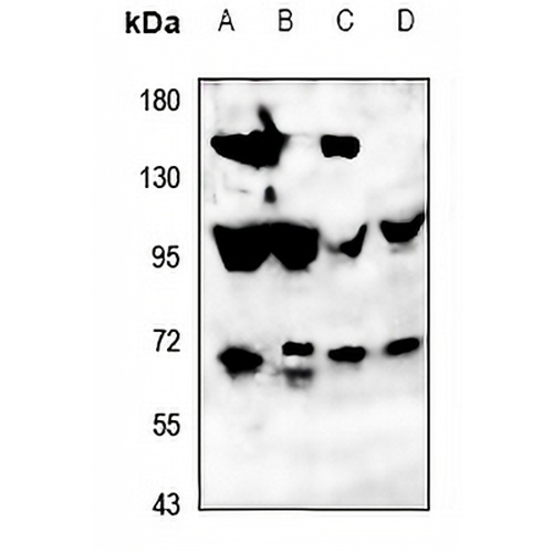 ATG16L2 Rabbit Polyclonal Antibody