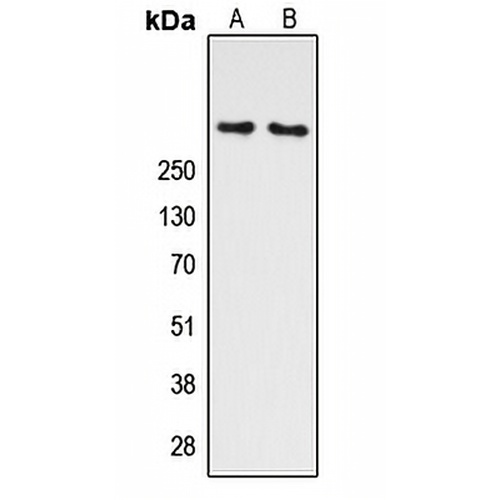 ATM (Phospho-S1981) Rabbit Polyclonal Antibody