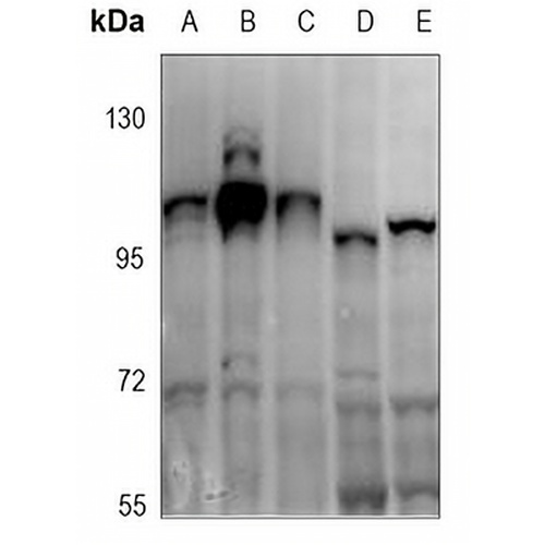 ATP1A1 (Phospho-S16) Rabbit Polyclonal Antibody