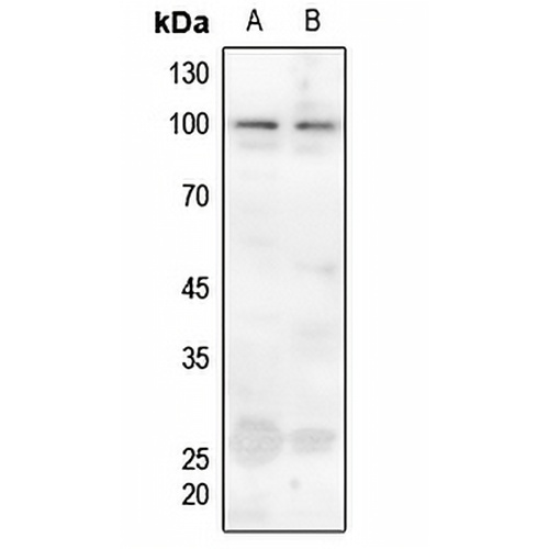 Ataxin 1 (Phospho-S775) Rabbit Polyclonal Antibody