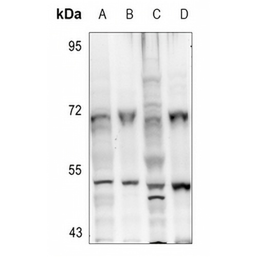 Aurora A (Phospho-T288) Rabbit Polyclonal Antibody