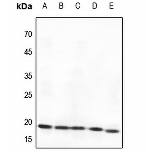 BAD Rabbit Polyclonal Antibody