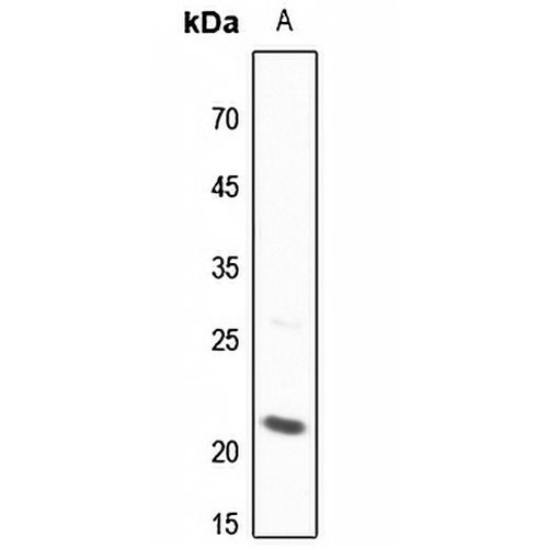BID Rabbit Polyclonal Antibody