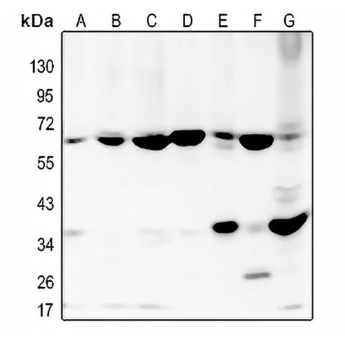 BMP2 Rabbit Polyclonal Antibody