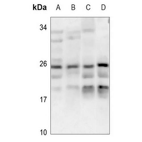 CABP7 Rabbit Polyclonal Antibody