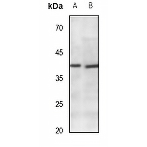 CACNG7 Rabbit Polyclonal Antibody