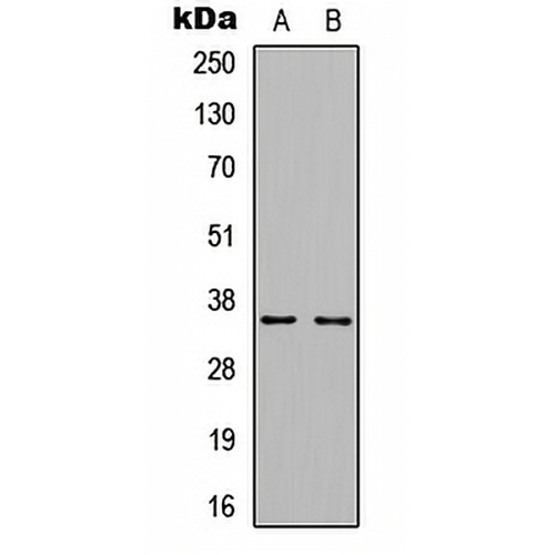 Cyclin D1 (Phospho-T286) Rabbit Polyclonal Antibody