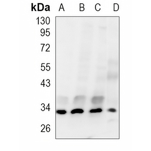 Cyclin D1 Rabbit Polyclonal Antibody