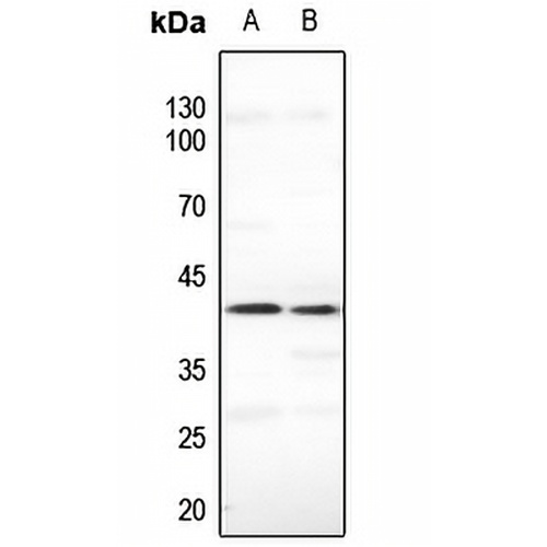 CDKL1 Rabbit Polyclonal Antibody