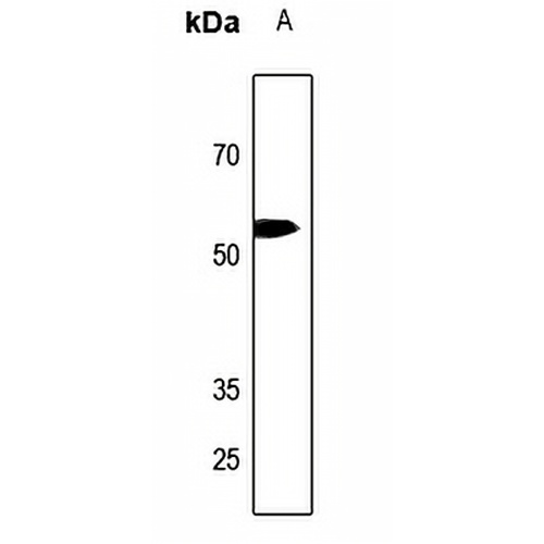 p57 Kip2 Rabbit Polyclonal Antibody