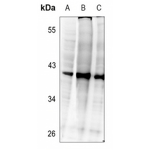 C/EBP beta (Phospho-T235) Rabbit Polyclonal Antibody