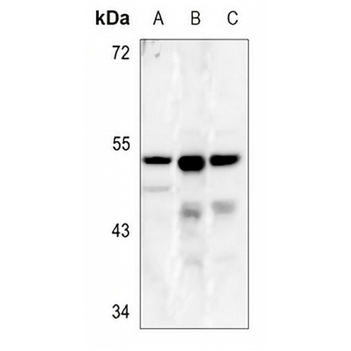 CLN5 Rabbit Polyclonal Antibody