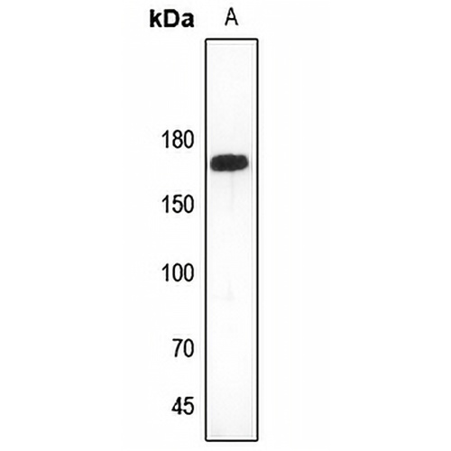 Collagen 11 alpha 2 Rabbit Polyclonal Antibody
