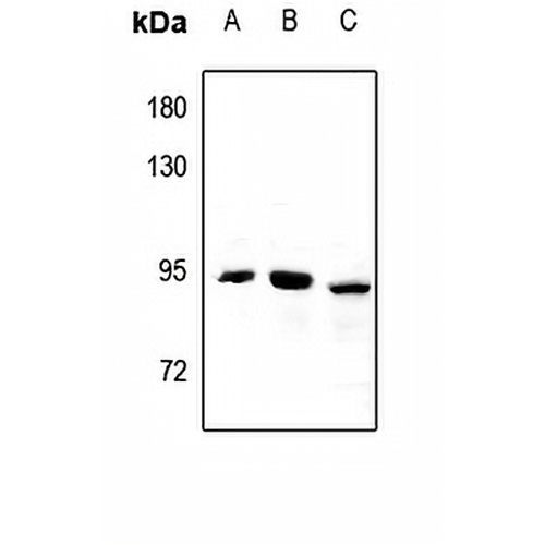 CPT1B Rabbit Polyclonal Antibody