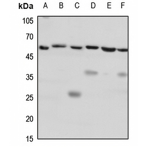 CD184 Rabbit Polyclonal Antibody