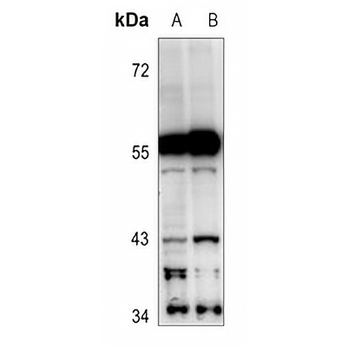 Cytochrome P450 2C19 Rabbit Polyclonal Antibody