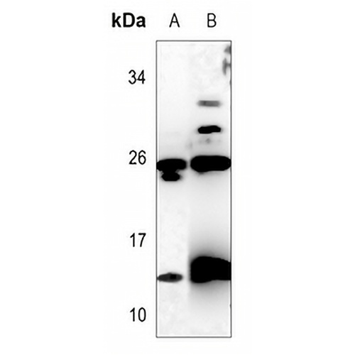 C17 Rabbit Polyclonal Antibody