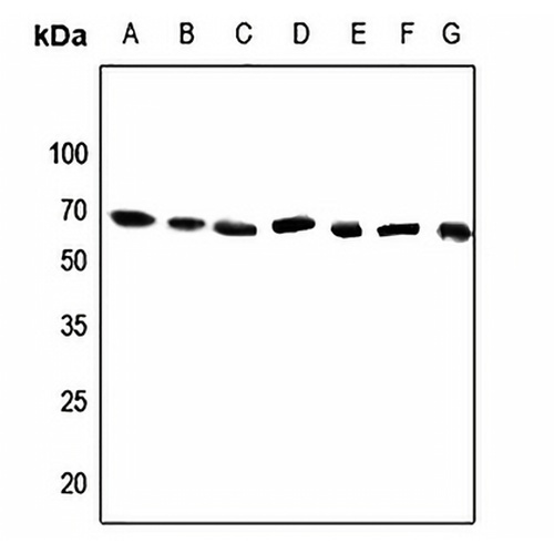 DDX52 Rabbit Polyclonal Antibody