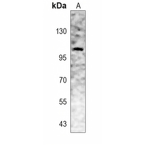 EEF2K Rabbit Polyclonal Antibody