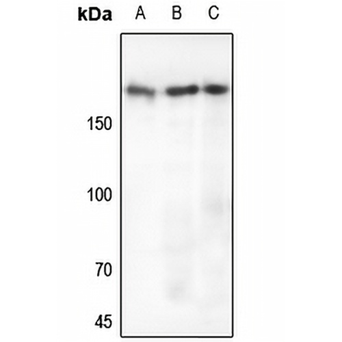 EGFR Rabbit Polyclonal Antibody