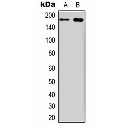 EGFR Rabbit Polyclonal Antibody