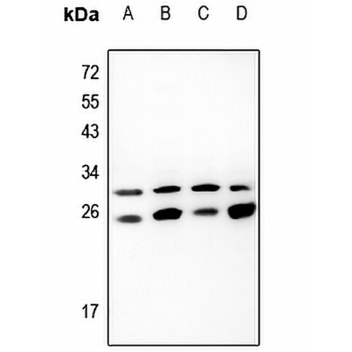 EIF3K Rabbit Polyclonal Antibody