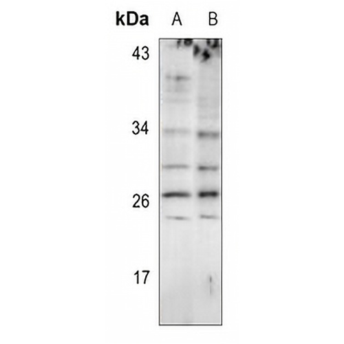 EIF4E3 Rabbit Polyclonal Antibody