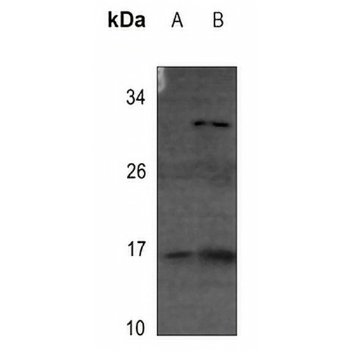 4EBP1 (Phospho-T69) Rabbit Polyclonal Antibody