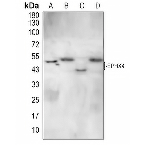 ABHD7 Rabbit Polyclonal Antibody