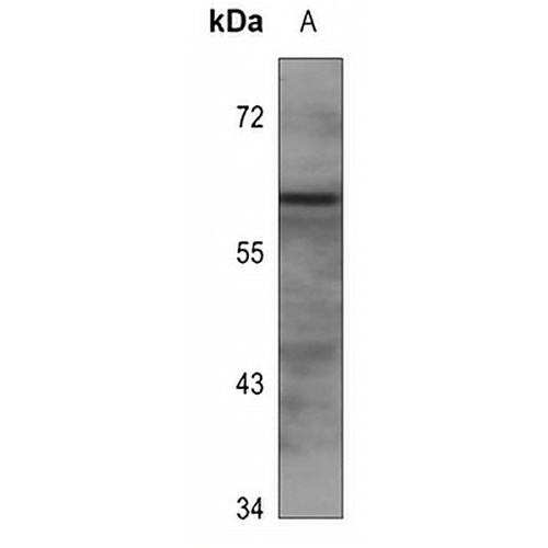 EPN2 Rabbit Polyclonal Antibody