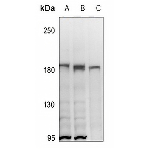 HER2 Rabbit Polyclonal Antibody