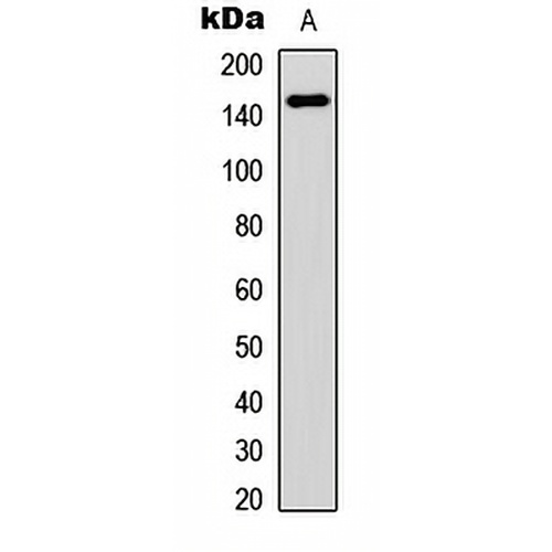 VEGFR1 Rabbit Polyclonal Antibody