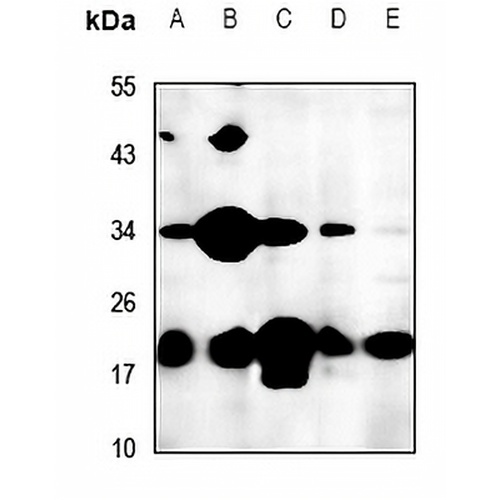 FTH1 Rabbit Polyclonal Antibody