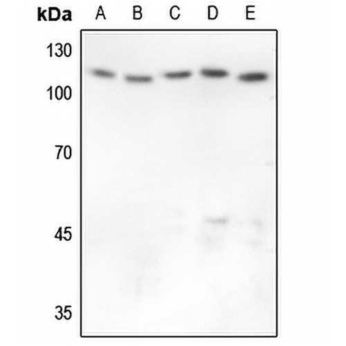 GAB1 Rabbit Polyclonal Antibody